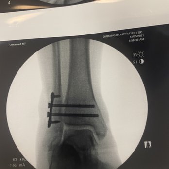 Kuruvilla Thomman M DPM - Text book surgery. Super clean! Couldn't of gone any better! - Podiatrists Near Me - Las Vegas, Nevada Kuruvilla Thomman M DPM - Text book surgery. Super clean! Couldn't of gone any better! - Podiatrists Near Me - Las Vegas, Nevada