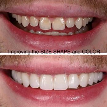 Precision Dental Care - General Dentistry Near Me - Duncanville, Texas