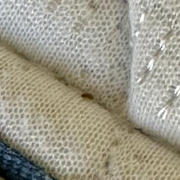 Bed Bug Egg Bed Bug Egg