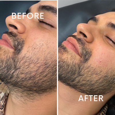 Face & Neck - Whether you need a full-body wax or a quick touch up, we are here to achieve your goals with our skilled esthetician, Alexis, that uses gentle techniques and high quality products. Call or visit website to book today!