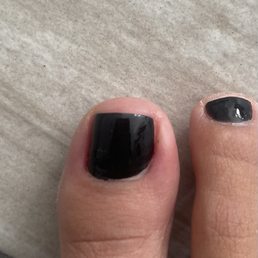 Toe all red and swollen.