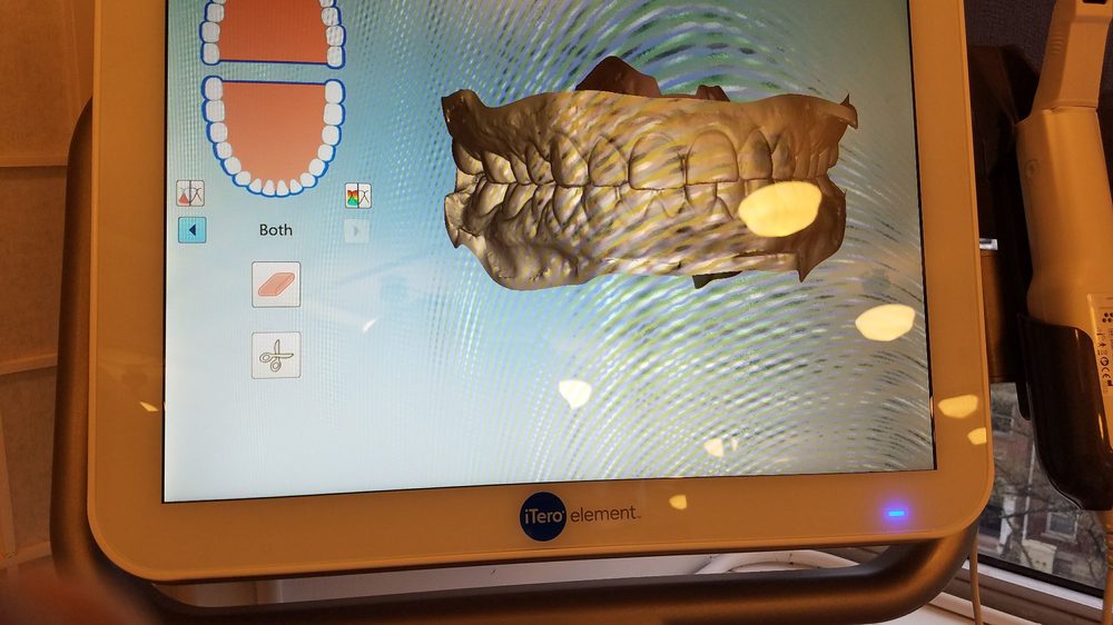 Photo of Smile Direct Club - Washington, DC, United States. 3D scan