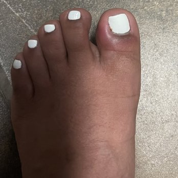 Crystal Nail - A day after the pedicure - Nail Salons Near Me - Modesto, California