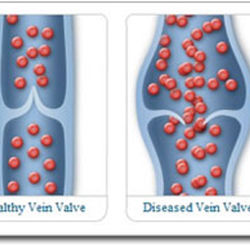 Tri-State Vein Center