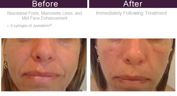 You Rejuvenated by null