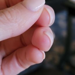 Picture of my finger that was DRILLED. Picture of my finger that was DRILLED.