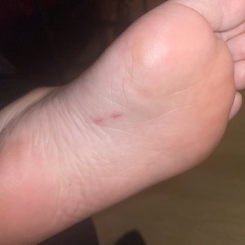 iNails & Spa - Next day the cut on my foot - Nail Salons Near Me - Burbank, California