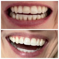 Kingwood Family & Cosmetic Dentistry - Before and After!