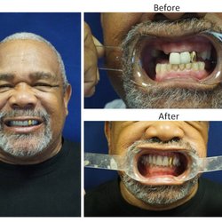 Uptown Cosmetic & Implant Dentistry - Before and After Results at Uptown Cosmetic & Implant Dentistry