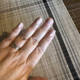Chipped thumb- broken middle nail and polish almost all the way off of the pointer finger after getting them done a day ago! Chipped thumb- broken middle nail and polish almost all the way off of the pointer finger after getting them done a day ago!