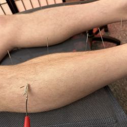 Augusta Acupuncture Clinic