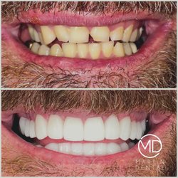 Martin Dental - Smile Makeover