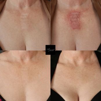 Studio Conceal - Permanent Makeup Near Me - Gilbert, Arizona Studio Conceal - Permanent Makeup Near Me - Gilbert, Arizona