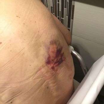 Harbor Care Homes - When asked how this happened, the staff shrugged their shoulder. - Retirement Homes Near Me - Mission Viejo, California Harbor Care Homes - When asked how this happened, the staff shrugged their shoulder. - Retirement Homes Near Me - Mission Viejo, California