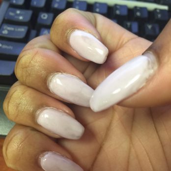 Nation Nails - Discolored nails - Nail Salons Near Me - Stone Mountain, Georgia Nation Nails - Discolored nails - Nail Salons Near Me - Stone Mountain, Georgia
