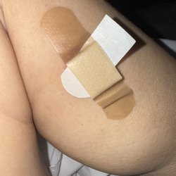 Sienna Dermatology - This is the bandaid covering the small hole where they removed the skin tag.  I put a piece of plastic on the sore to protect the wound.