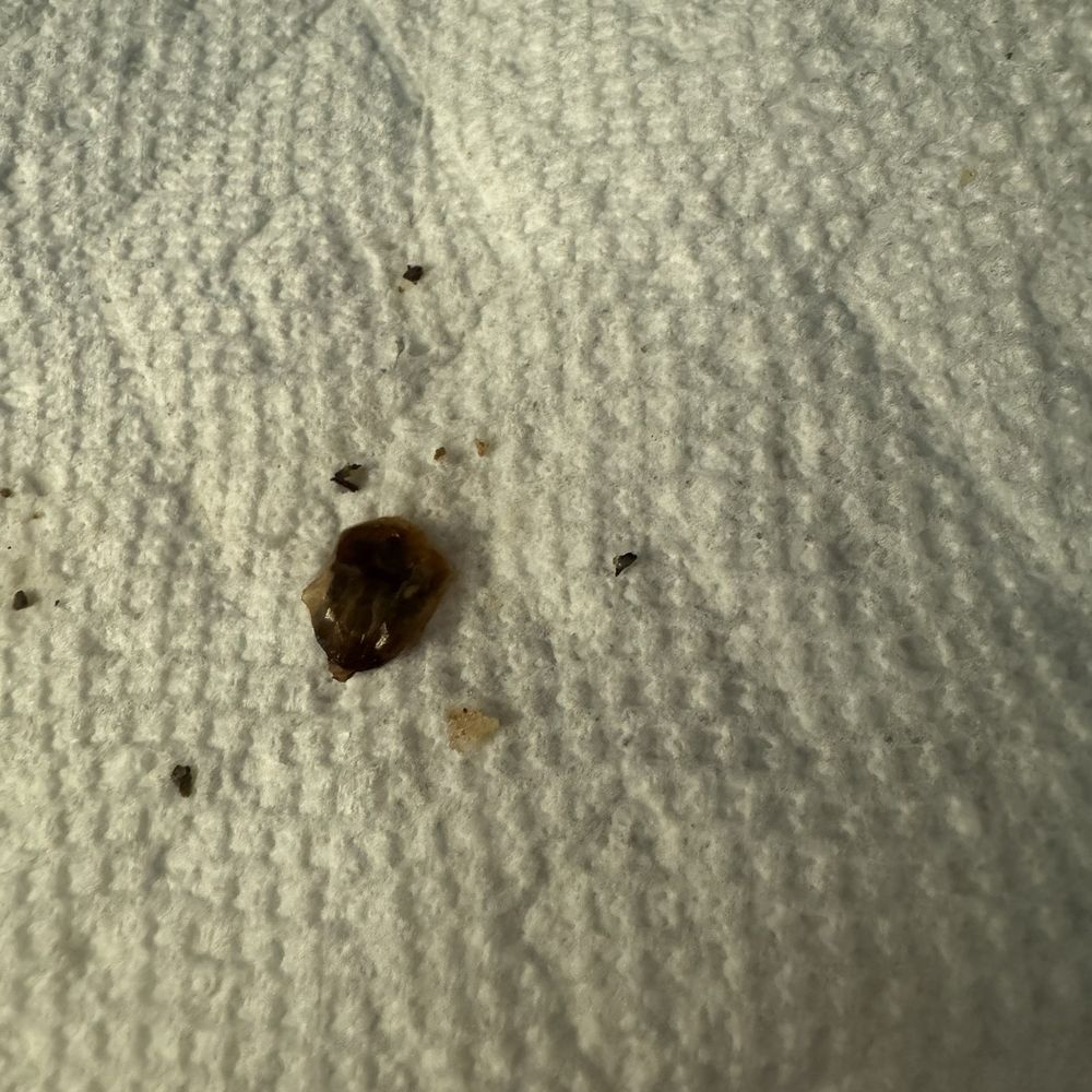 Dead ROACH shell/ body. Dead ROACH shell/ body.