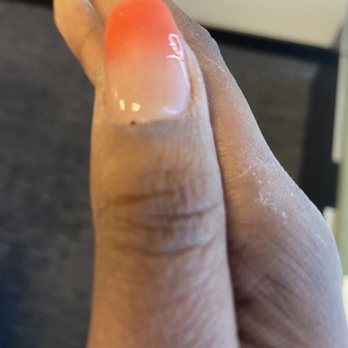 Top Coat Nail Spa - Bleeding cuticles - Nail Salons Near Me - Chicago, Illinois Top Coat Nail Spa - Bleeding cuticles - Nail Salons Near Me - Chicago, Illinois