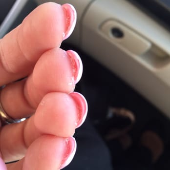 Perfect Nails & Co - Excessive glue under the nails :( - Nail Salons Near Me - Essex Junction, Vermont
