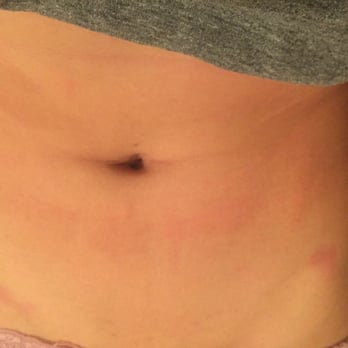 Total Tan - Burn everywhere! Worst customer service! - Teeth Whitening Near Me - West Hollywood, California Total Tan - Burn everywhere! Worst customer service! - Teeth Whitening Near Me - West Hollywood, California