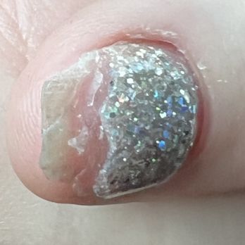 European Nails & Spa - He used a grinder on healthy strong nail. - Nail Salons Near Me - Mesa, Arizona European Nails & Spa - He used a grinder on healthy strong nail. - Nail Salons Near Me - Mesa, Arizona