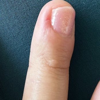 Lavish Organic Nail Spa - cut finger - Nail Salons Near Me - Dallas, Texas Lavish Organic Nail Spa - cut finger - Nail Salons Near Me - Dallas, Texas