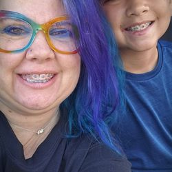 Teeters Orthodontics - My son and I rocking our braces!