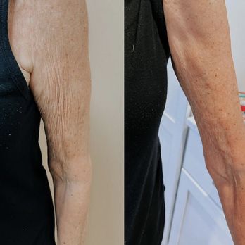 Collagen Project - Medical Spas Near Me - Miami Beach, Florida