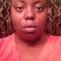 NIGHTMARE 4 month healing process! NIGHTMARE 4 month healing process!
