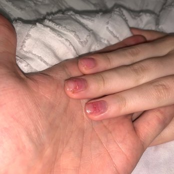Nails At New Tampa - Nails two days later with hardener to keep the nails together and minimize pain - Nail Salons Near Me - Tampa, Florida Nails At New Tampa - Nails two days later with hardener to keep the nails together and minimize pain - Nail Salons Near Me - Tampa, Florida