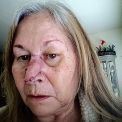 Penn State Dermatology - This was a carve job in my opinion