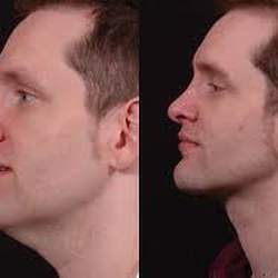 Thomae Surgical