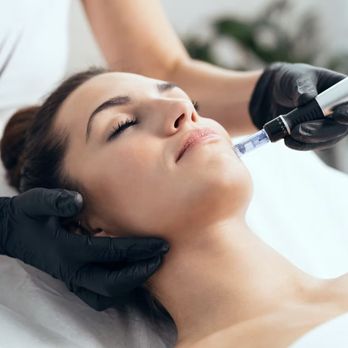 Auralite Acupuncture - Microneedling and Holistic Facial Rejuvenation - Acupuncture Near Me - Santa Barbara, California Auralite Acupuncture - Microneedling and Holistic Facial Rejuvenation - Acupuncture Near Me - Santa Barbara, California