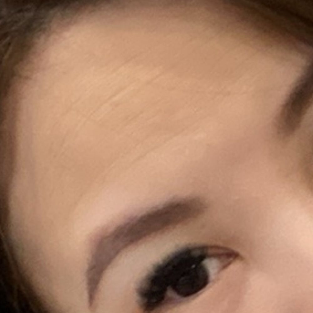 Neuskin Aesthetics - my crows feet "before" pic near my eye u can see the crease and the lines on forehead - Aestheticians Near Me - Irving, Texas Neuskin Aesthetics - my crows feet "before" pic near my eye u can see the crease and the lines on forehead - Aestheticians Near Me - Irving, Texas