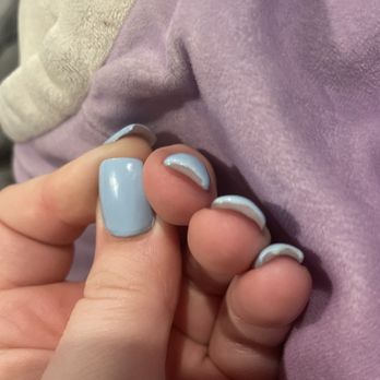 Glossy Nails - Thick and uneven nails - Nail Salons Near Me - Countryside, Illinois Glossy Nails - Thick and uneven nails - Nail Salons Near Me - Countryside, Illinois