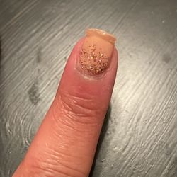 Happy Nails - Chipped/ peeling gel polish