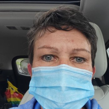 Advanced Dermatology and Cosmetic Surgery - Left eyelid droop. Look close to see the lid close to the pupil. - Dermatologists Near Me - St. Augustine, Florida