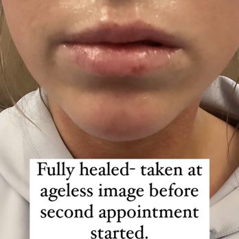 Ageless Image - Skin Care Near Me - Santa Rosa, California