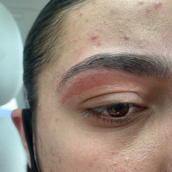 Kai’s Nail Spa - Burn from getting eyebrow wax - Nail Salons Near Me - Davie, Florida Kai’s Nail Spa - Burn from getting eyebrow wax - Nail Salons Near Me - Davie, Florida