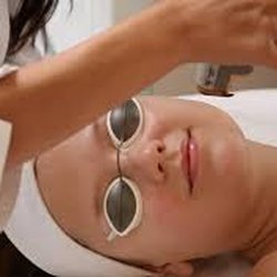 Mona Esthetics - Non=ablative Genesis laser.