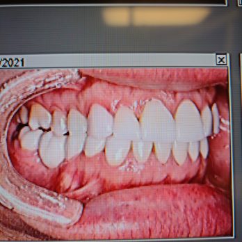 Ron Hart - General Dentistry Near Me - Bartlesville, Oklahoma