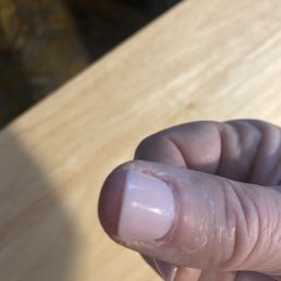 As you can see my nail has been clipped very short. You can also see all the extra polish on my skin. Very sloppy. As you can see my nail has been clipped very short. You can also see all the extra polish on my skin. Very sloppy.