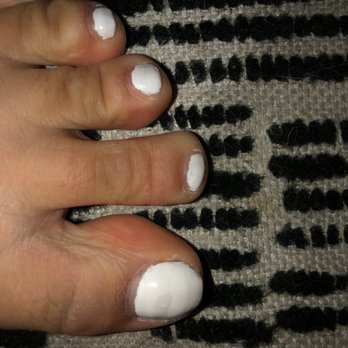 Aeon Nail Spa - I have ugly feet but should not look this bad. - Nail Salons Near Me - Killeen, Texas
