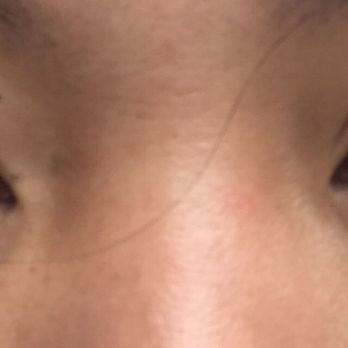 Eyelashes R Us - After - Waxing Near Me - Chicago, Illinois Eyelashes R Us - After - Waxing Near Me - Chicago, Illinois