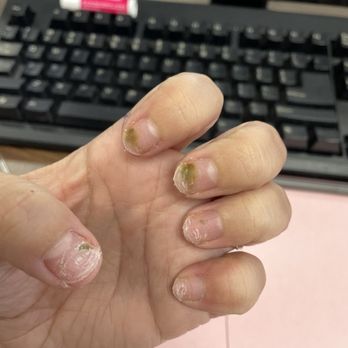 Model Nail Salon - Fungus or "water damage" nails? - Nail Salons Near Me - Bakersfield, California