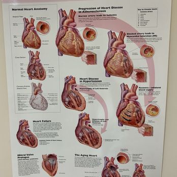 Wisconsin Cardiovascular Group - Cardiologists Near Me - Milwaukee, Wisconsin Wisconsin Cardiovascular Group - Cardiologists Near Me - Milwaukee, Wisconsin