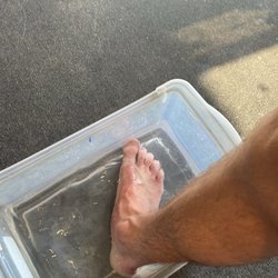 Huntington Surf & Sport - Sting ray bite