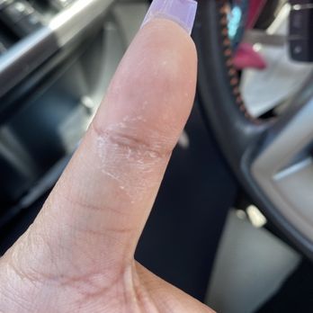 NailBox Studios - Dried gel on my skin - Hair Removal Near Me - Castro Valley, California