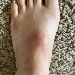 Happiness Nails Spa - My foot the first day