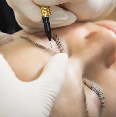 Eyebrows - Electrolysis for the eyebrows